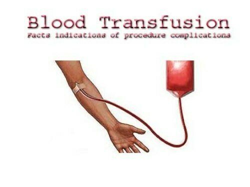 Blood Transfusion Facts Risks Procedures Side Effects