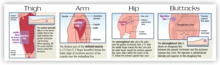 Injection Definition Types Purposes